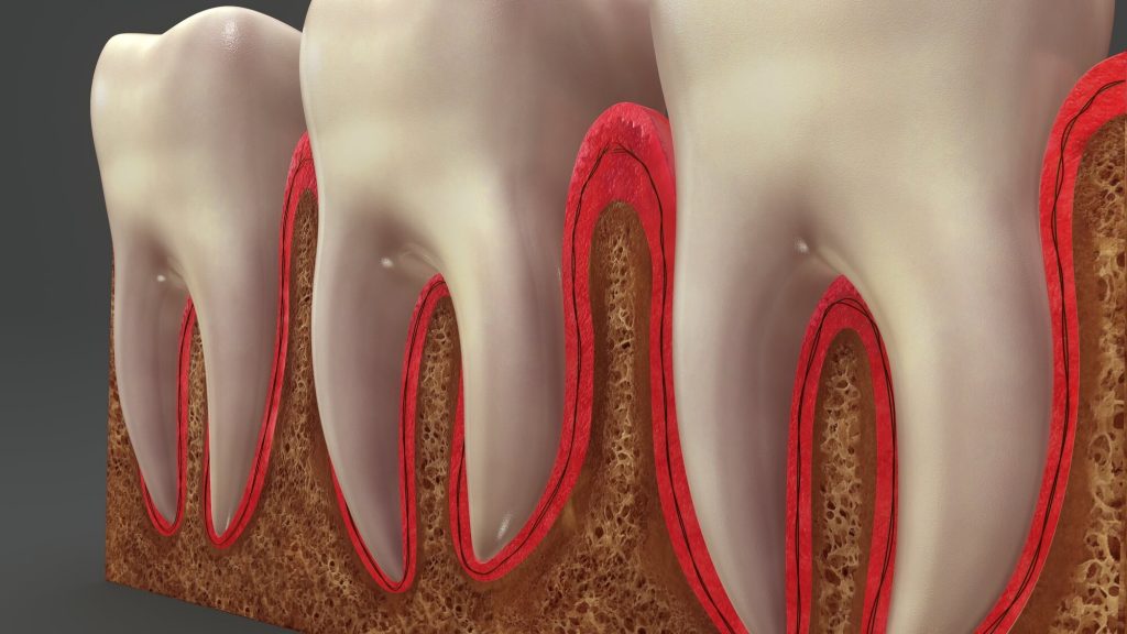 Looking for the Best Dentist Weston to Treat Gum Disease?