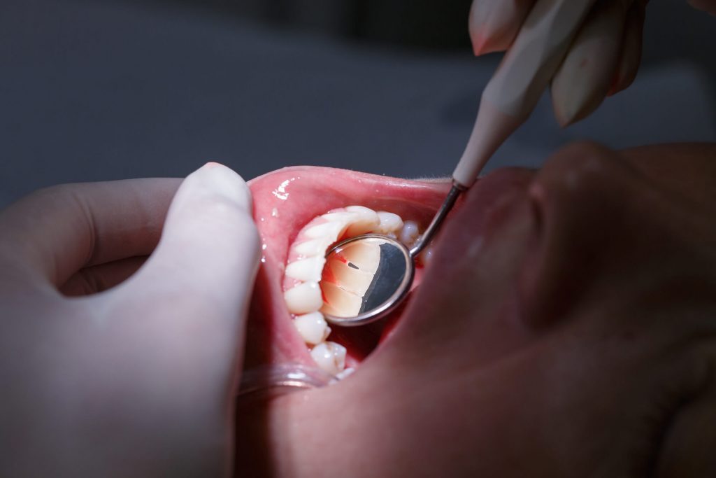 Where is the Best Dentist in Davie FL?
