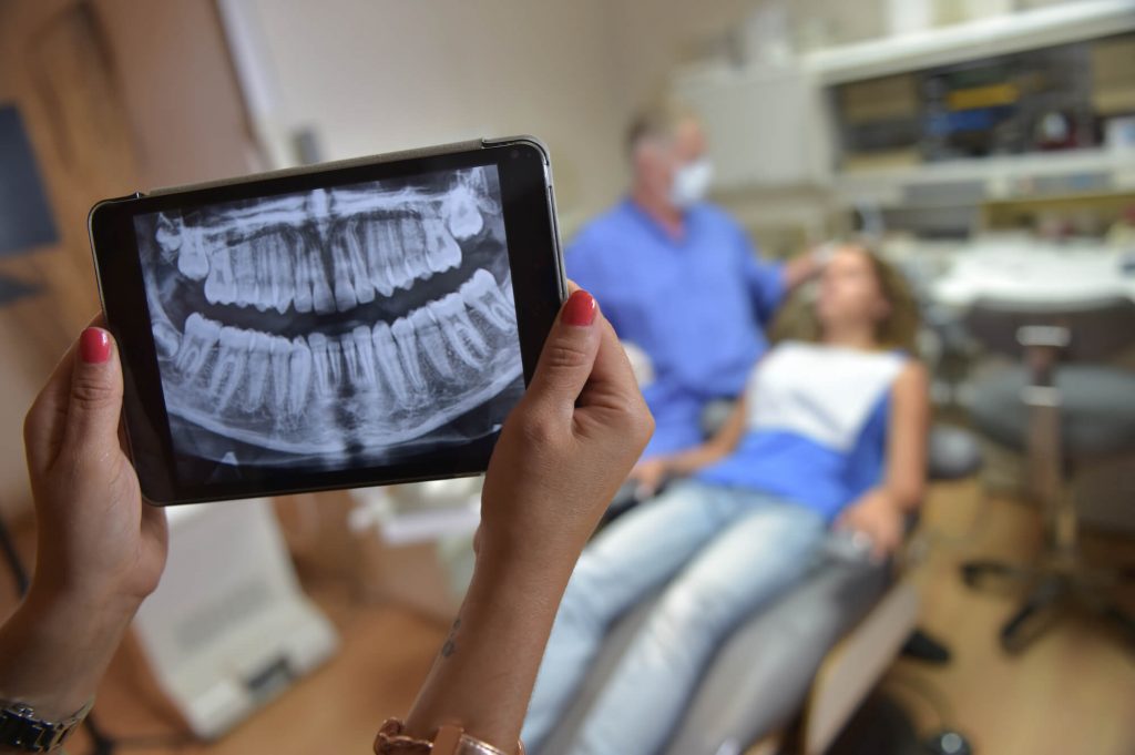 close up of the Best dentist in plantation fl holding a digital xray